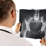 Arzt mit Röntgenaufnahme